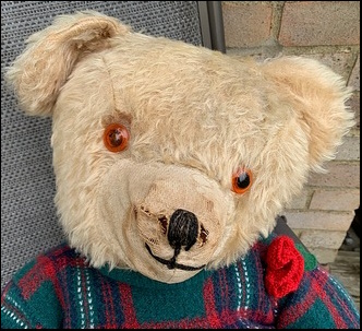Anne M.'s William John before treatment