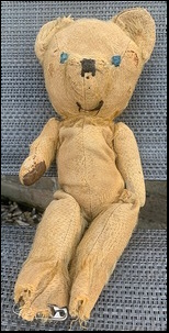 Jane S.'s Ted before treatment